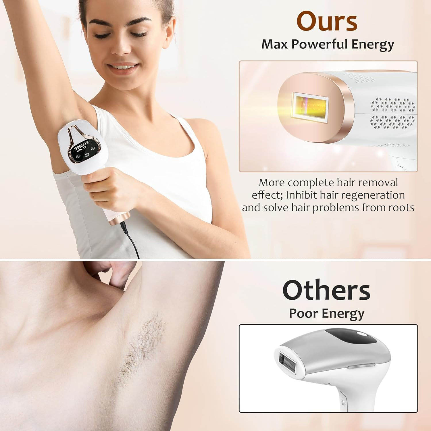 Ipl Hair Removal Laser Epilato - огляд і ціна Opt Ipl Laser Hair Removal Machine