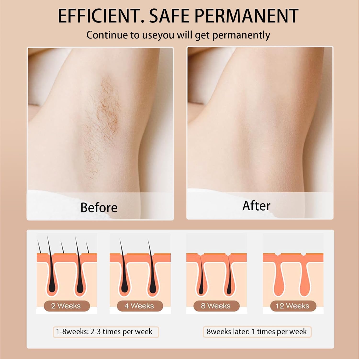 Ipl Hair Removal Laser Epilato - огляд і ціна Opt Ipl Laser Hair Removal Machine