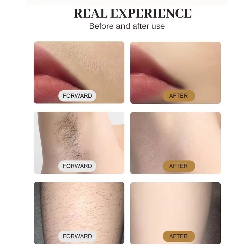 808nm Diode Laser Hair Removal - огляд і ціна Cooling Gel For Laser Hair Removal