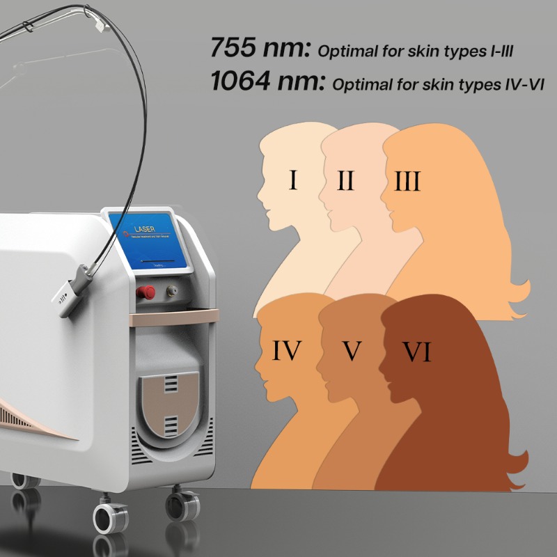 1064Nm Long Pulse Nd Yag Laser - огляд і ціна Alexandrite Laser Hair Removal Machine