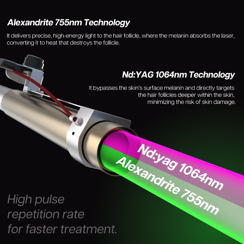 1064Nm Long Pulse Nd Yag Laser - огляд і ціна Alexandrite Laser Hair Removal Machine