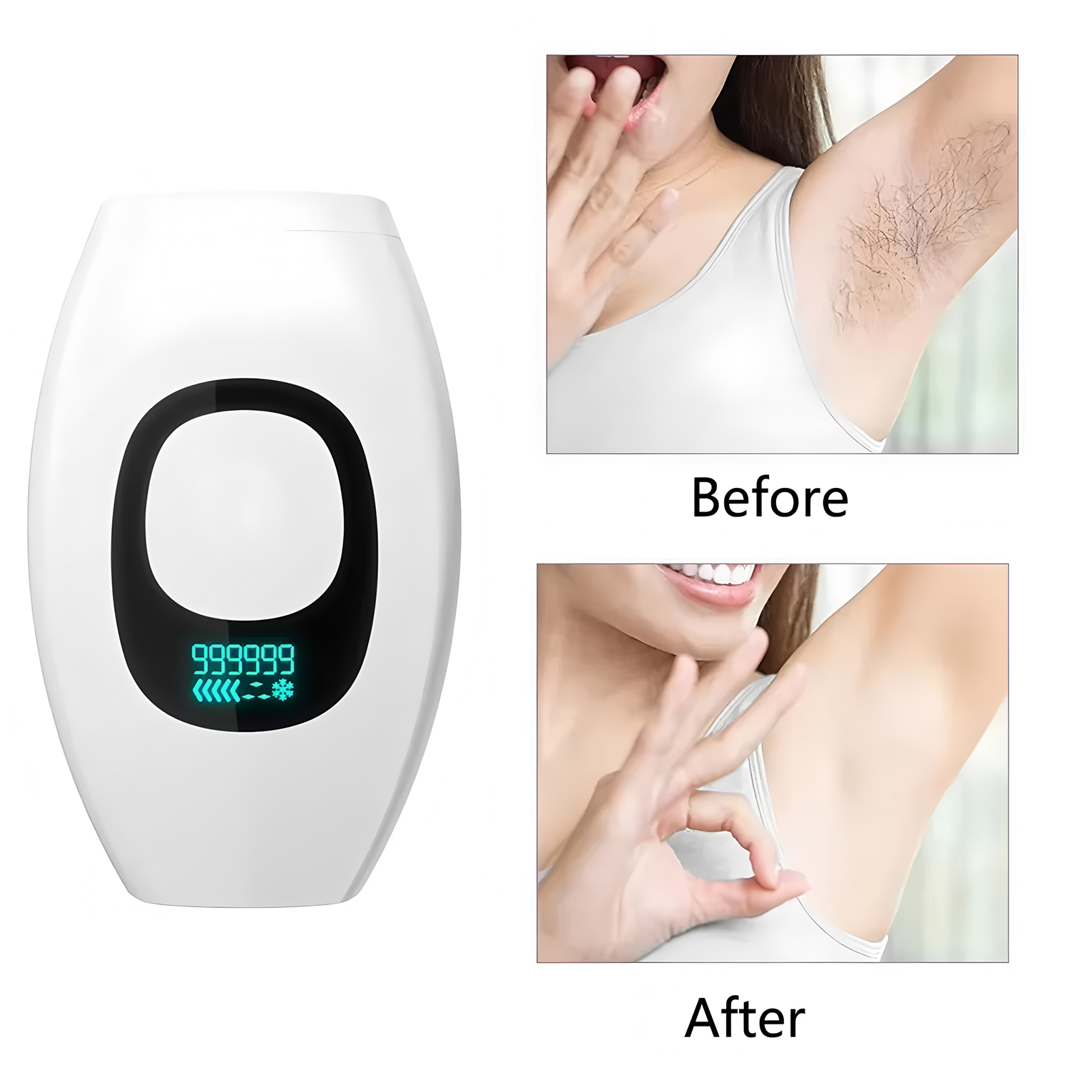 Digital Display IPL 500,000 Fl - огляд і ціна Ipl Hair Removal Handset Permanent