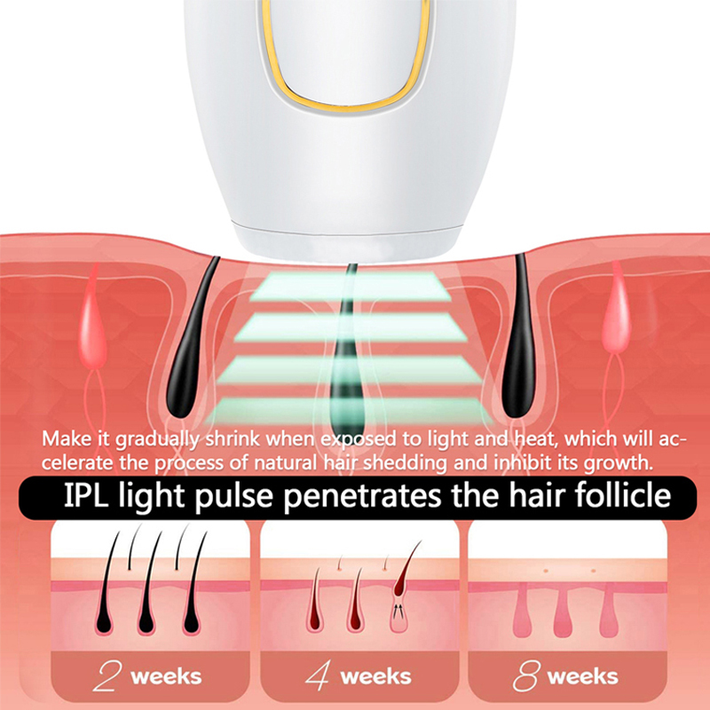Professional Permanent Laser D - огляд і ціна Ipl Hair Removal Handset Permanent