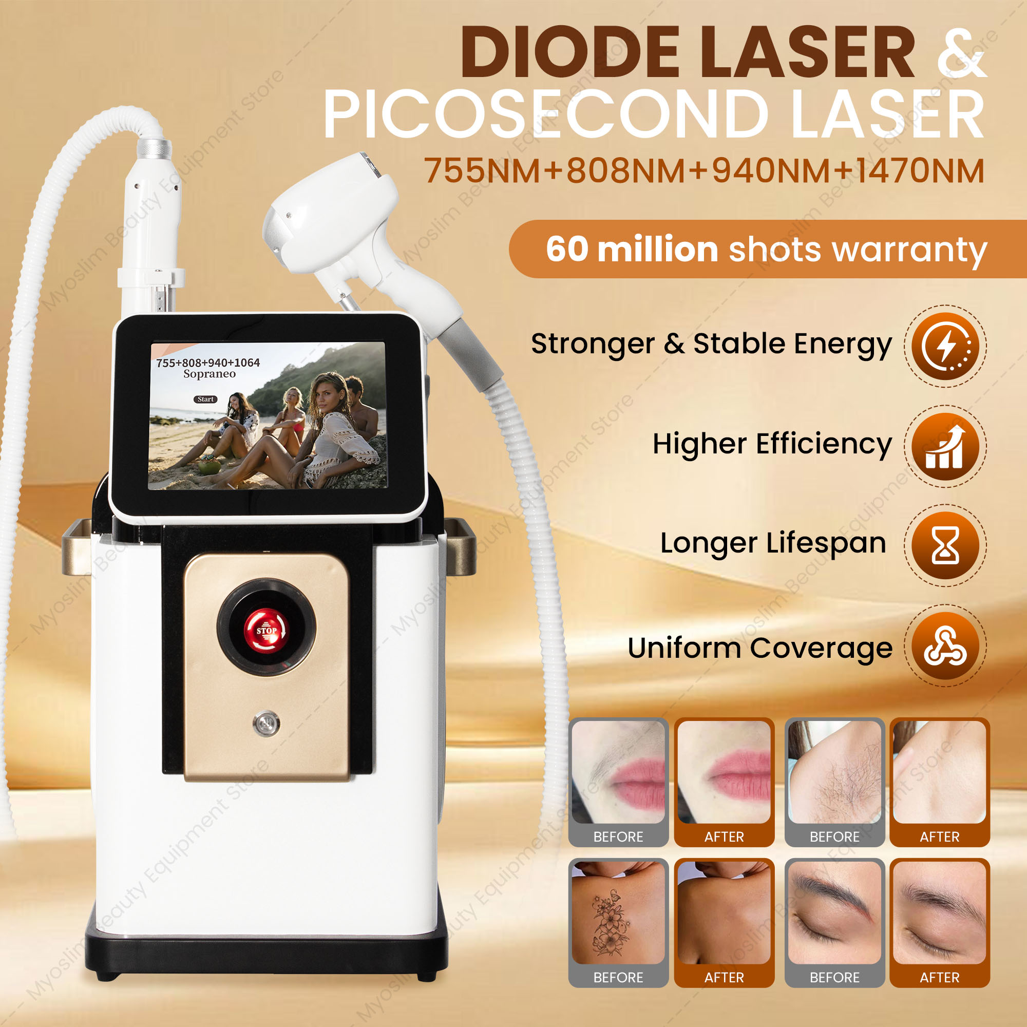Two-in-One 755nm 808nm 810nm 8 - огляд і ціна Diode Laser Hair Removal 808Nm 755Nm 1064Nm