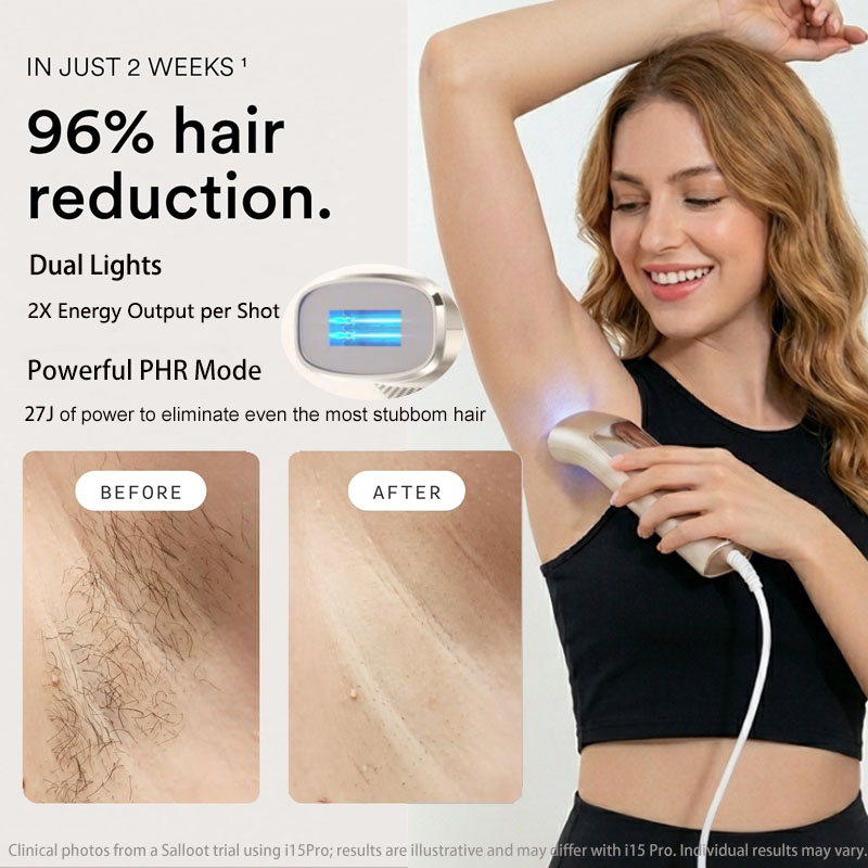 Trinity I15 Pro Sapphire Ice C - огляд і ціна Home Ipl Hair Removal Sapphire Cooling