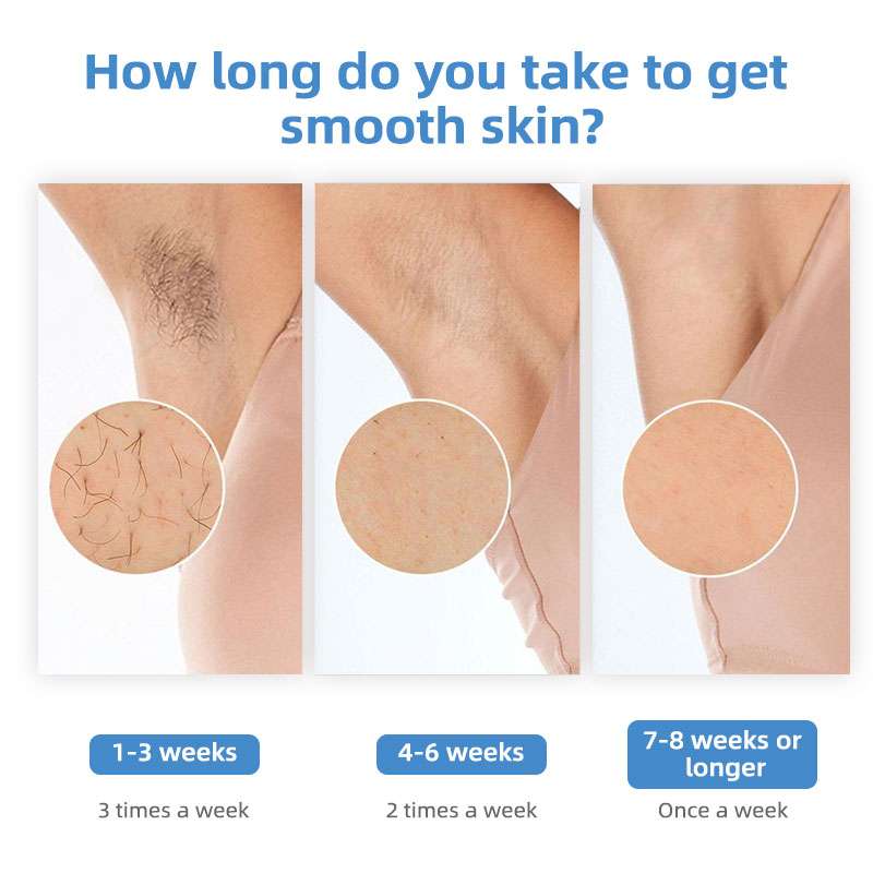 IShine Sapphire Ice Cooling IP - огляд і ціна Home Ipl Hair Removal Sapphire Cooling