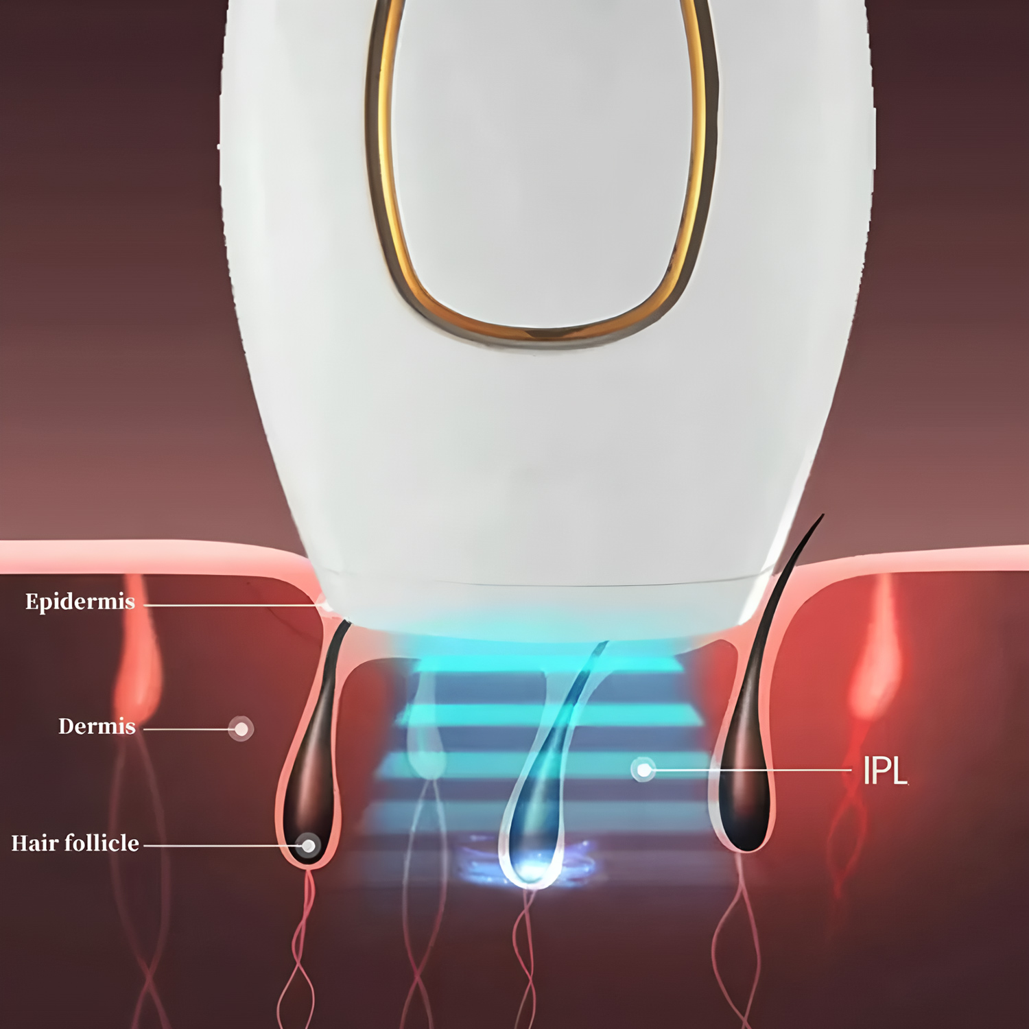 Laser Epilator IPL Hair Remova - огляд і ціна Opt Ipl Laser Hair Removal Machine